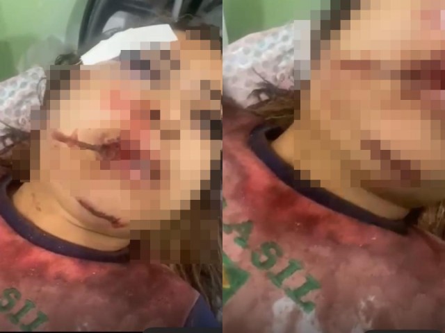  Garota de programa � brutalmente agredida e quase morta em VG
