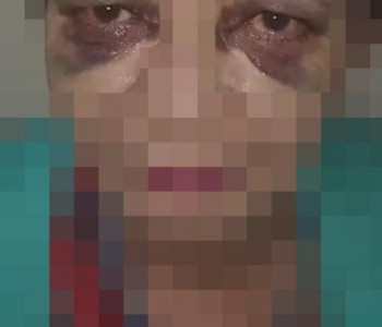 Mulher nega comida e bebida para pedinte e acaba espancada em MT